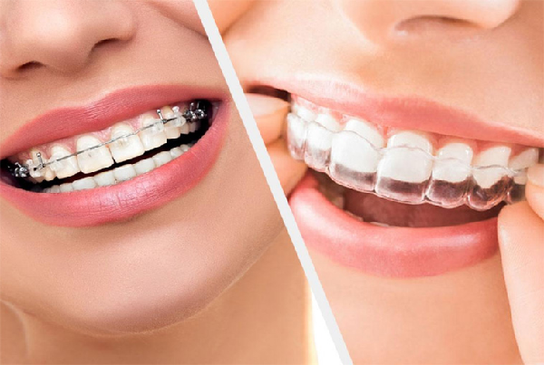 Dental Care